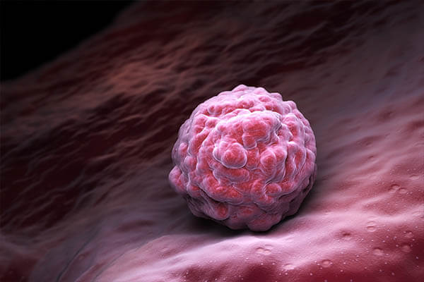 Stem Cell Therapy Market Expected To Reach US$ 15,075.5 Million By 2023 