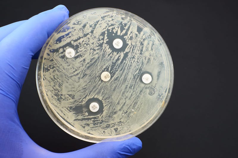 Antimicrobial Susceptibility Testing Market Fueling Growth Of Infection Management