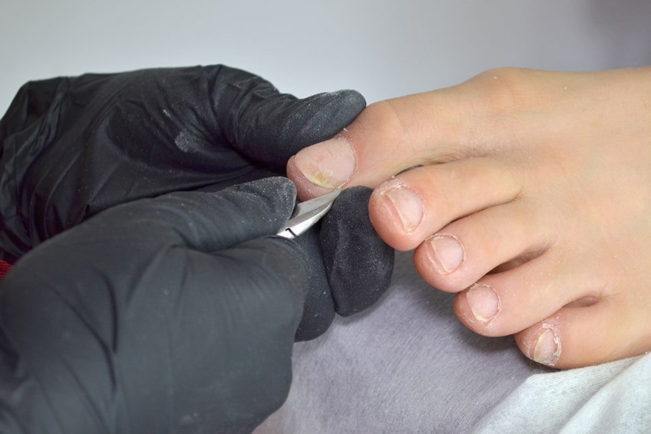 Top 10 Common Drugs Detected in a 5 and 10 Panel Nail Drug Test