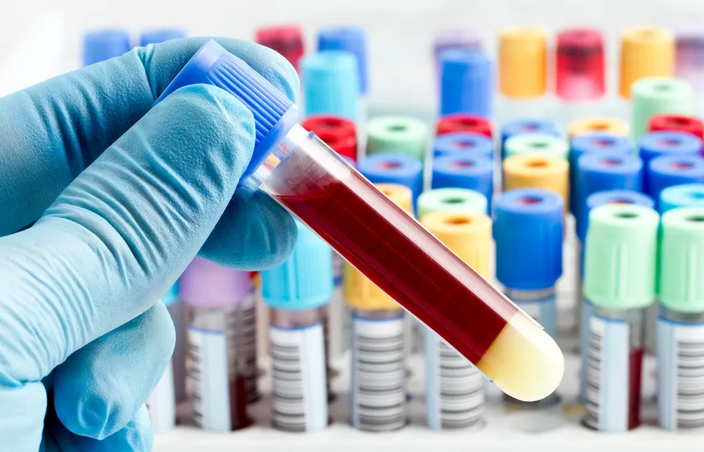 Blood plasma derivatives: Lifesaving components separated from donated blood