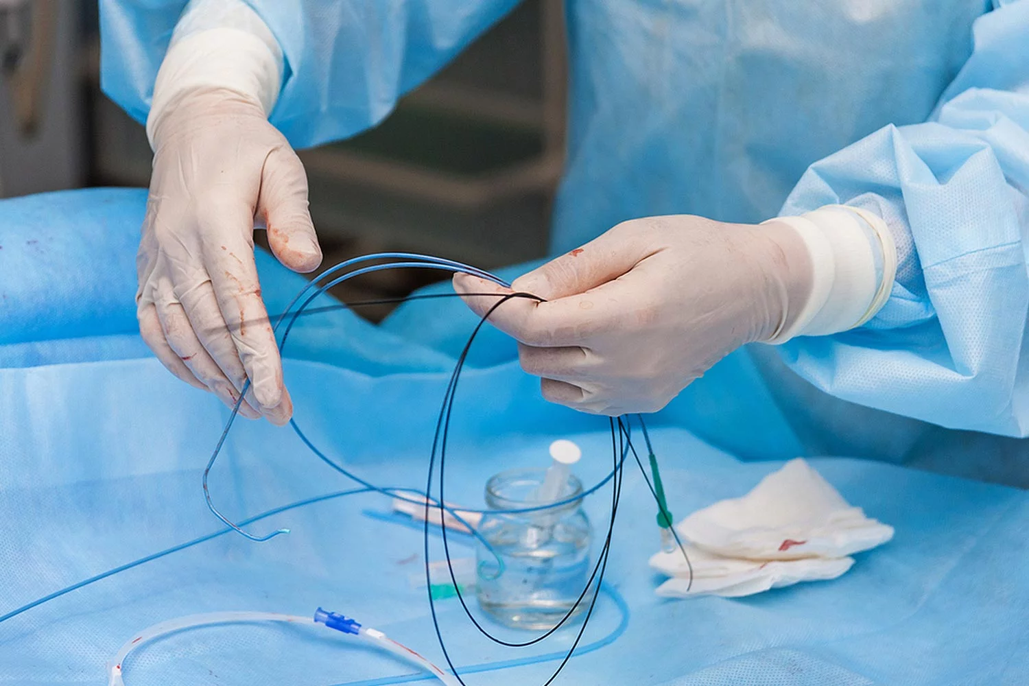 The global Cerebral Angiography Market Growth is Accelerated by Rising Preference for Minimally-Invasive Procedures