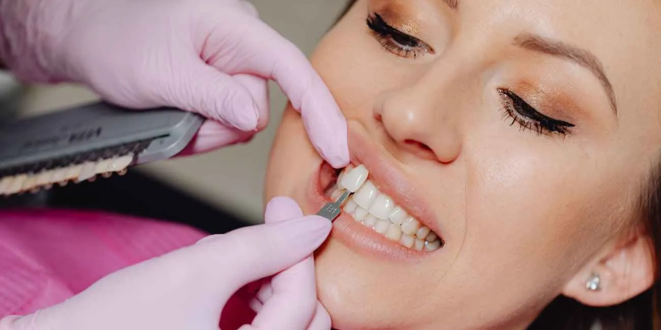 A Closer Look at Veneer Costs: White Perfect Dental's Competitive Edge
