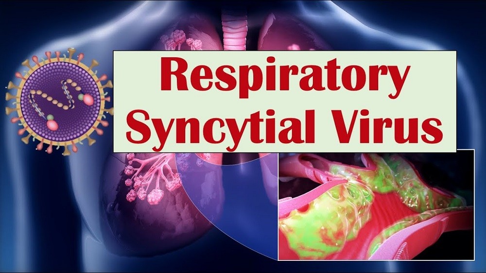 Respiratory Syncytial Virus Diagnostics Market 2022 Size, Growth Factors & Forecast Report to 2030