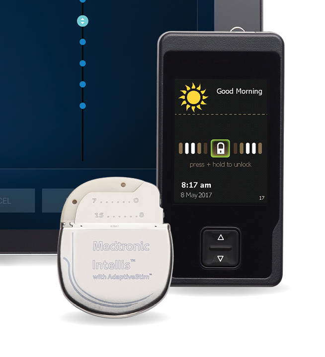 Spinal Cord Stimulation Devices Market Size, In-depth Analysis Report and Global Forecast to 2030