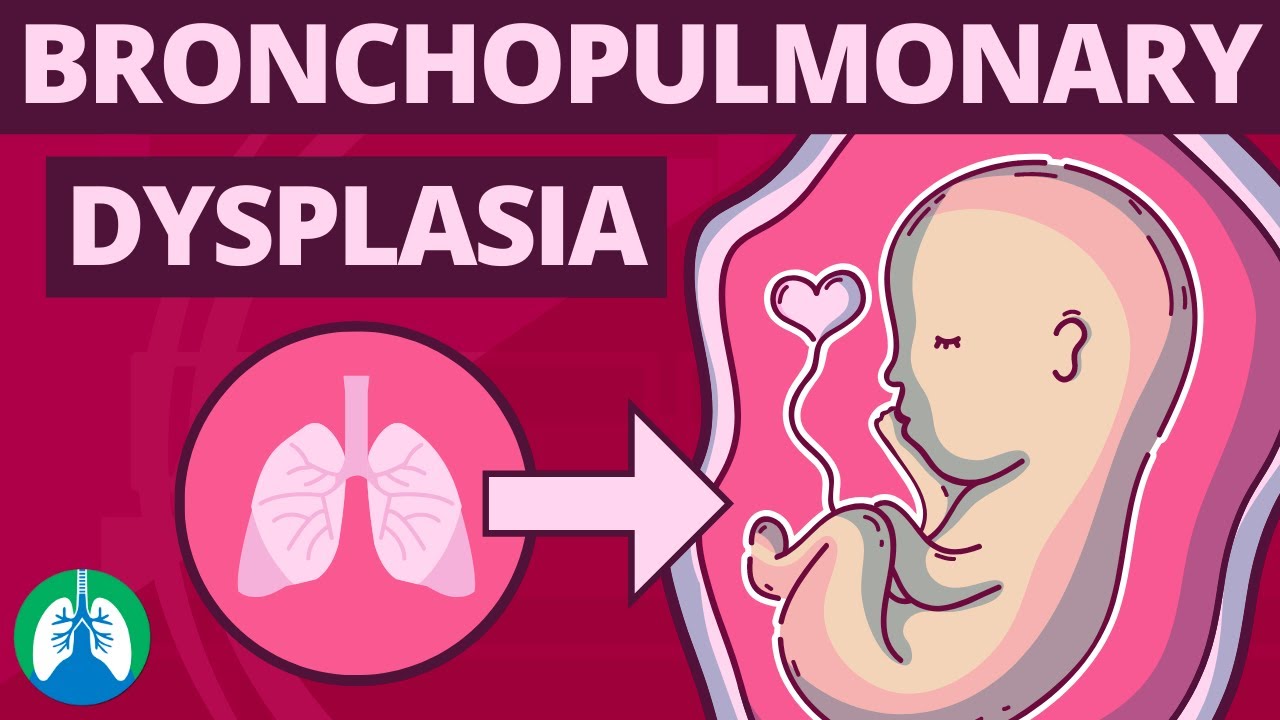 Bronchopulmonary Dysplasia Market Size, Share, Regional Overview and Global Forecast to 2030