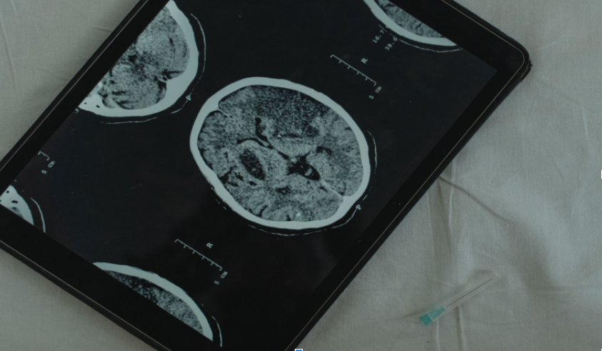 Saving Lives, One Image at a Time: The Importance of CT Scans