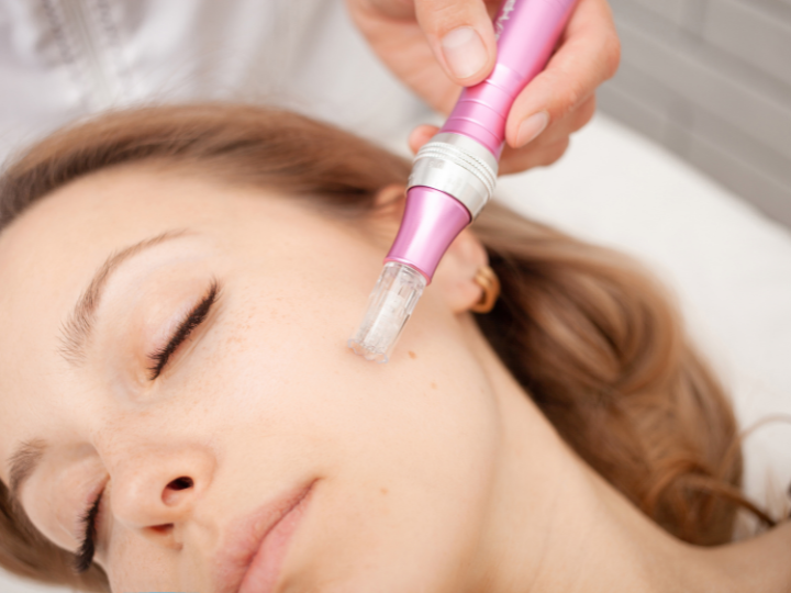 Microneedling vs. Skin Needling: Which is Right for Your Skin?