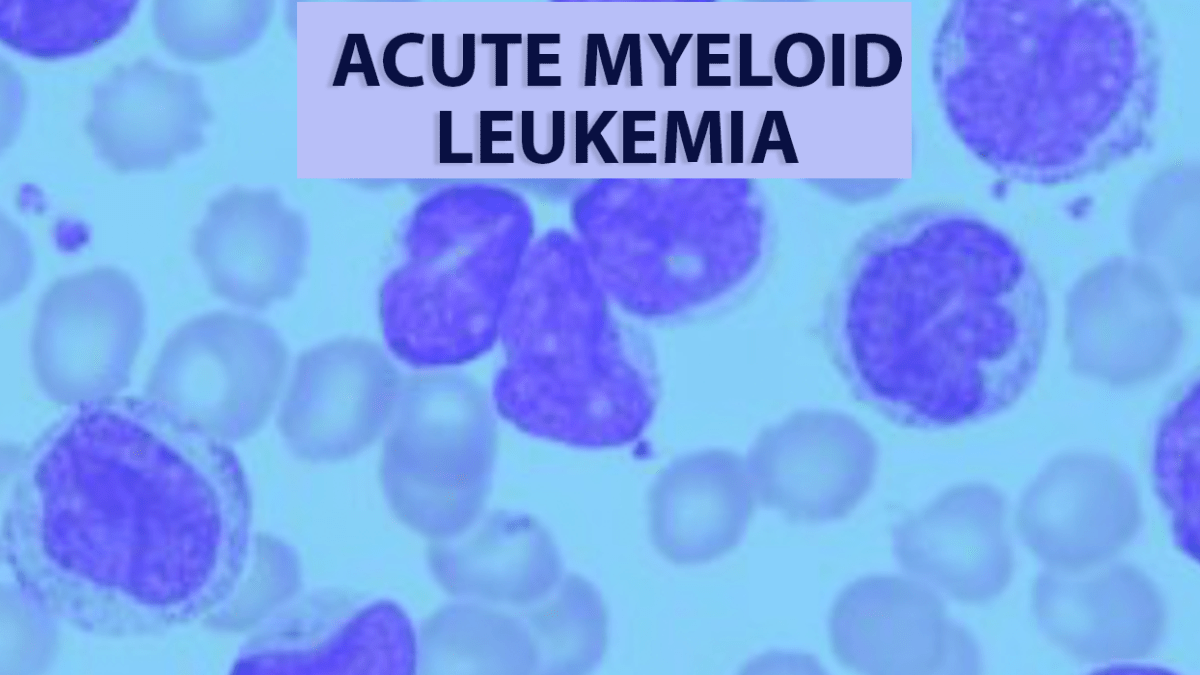 Acute Myeloid Leukemia Therapeutics Market 2022 Major Key Players and Industry Analysis Till 2030