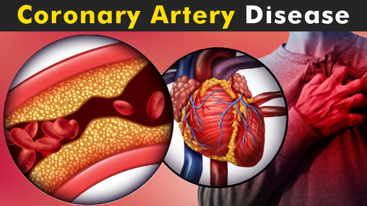 Coronary Artery Disease Market Size, Share, Regional Overview and Global Forecast to 2030