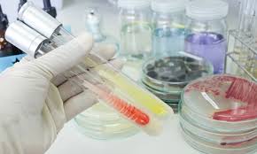 Pharmaceutical Rapid Microbiology Testing Market: Detailed Insights on Size, Share, Growth Potential