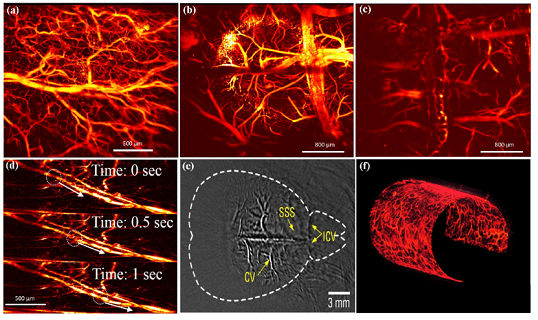 Market Dynamics of Photoacoustic Tomography: Analyzing Current Size, Growth Trends