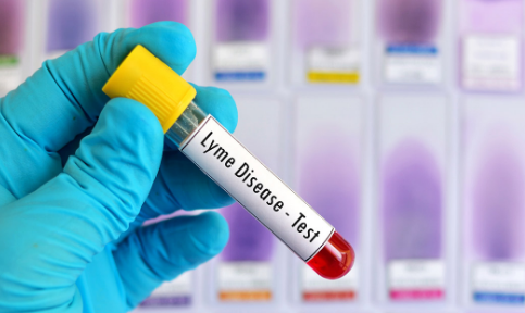 Lyme Disease Testing Market In-Depth Study: Evaluating Market Size, Share, Growth Forecast