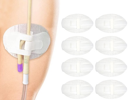 Catheter Stabilization Devices Products: Understanding Market Size, Share, and Growth Trajectories
