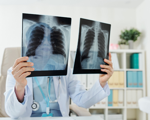 Navigating Lung Cancer: Top Thoracic Oncology Hospitals and Specialists in Delhi