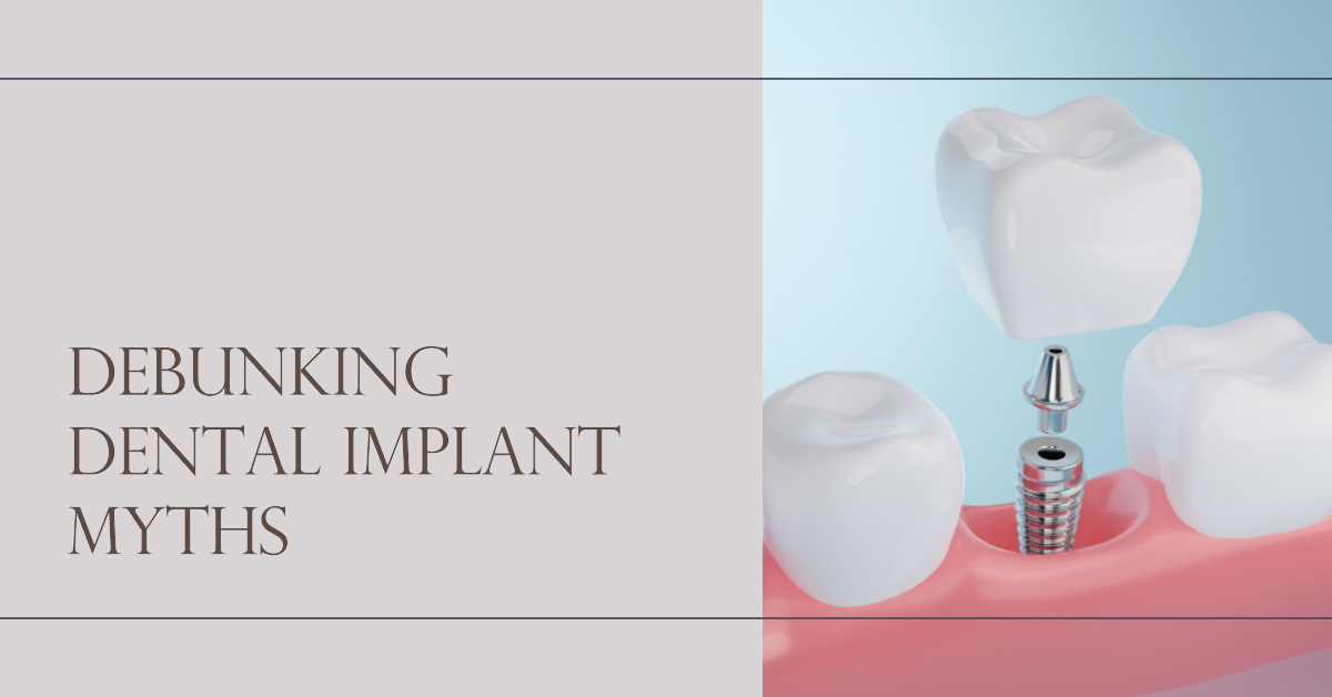 Dental Implant Myths Busted: Debunking 10 Common Misconceptions