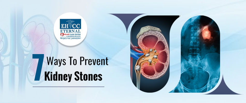 Seven Ways To Prevent Kidney Stones