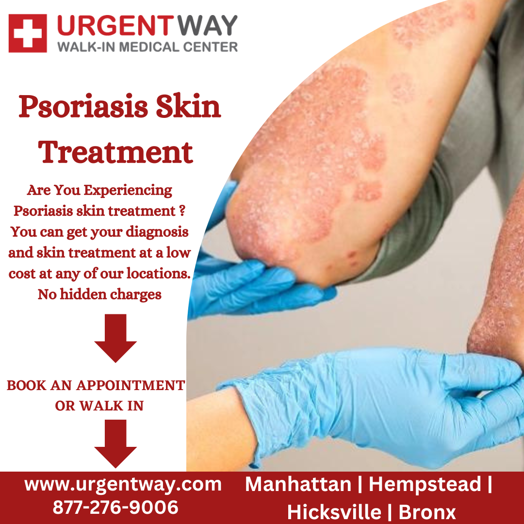 How quickly can improvements be expected with different psoriasis treatments?