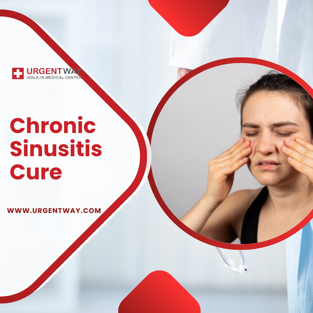 Can chronic sinusitis cure recur even after successful treatment?