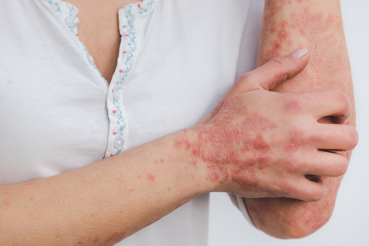 Top Reasons Behind Skin Allergy