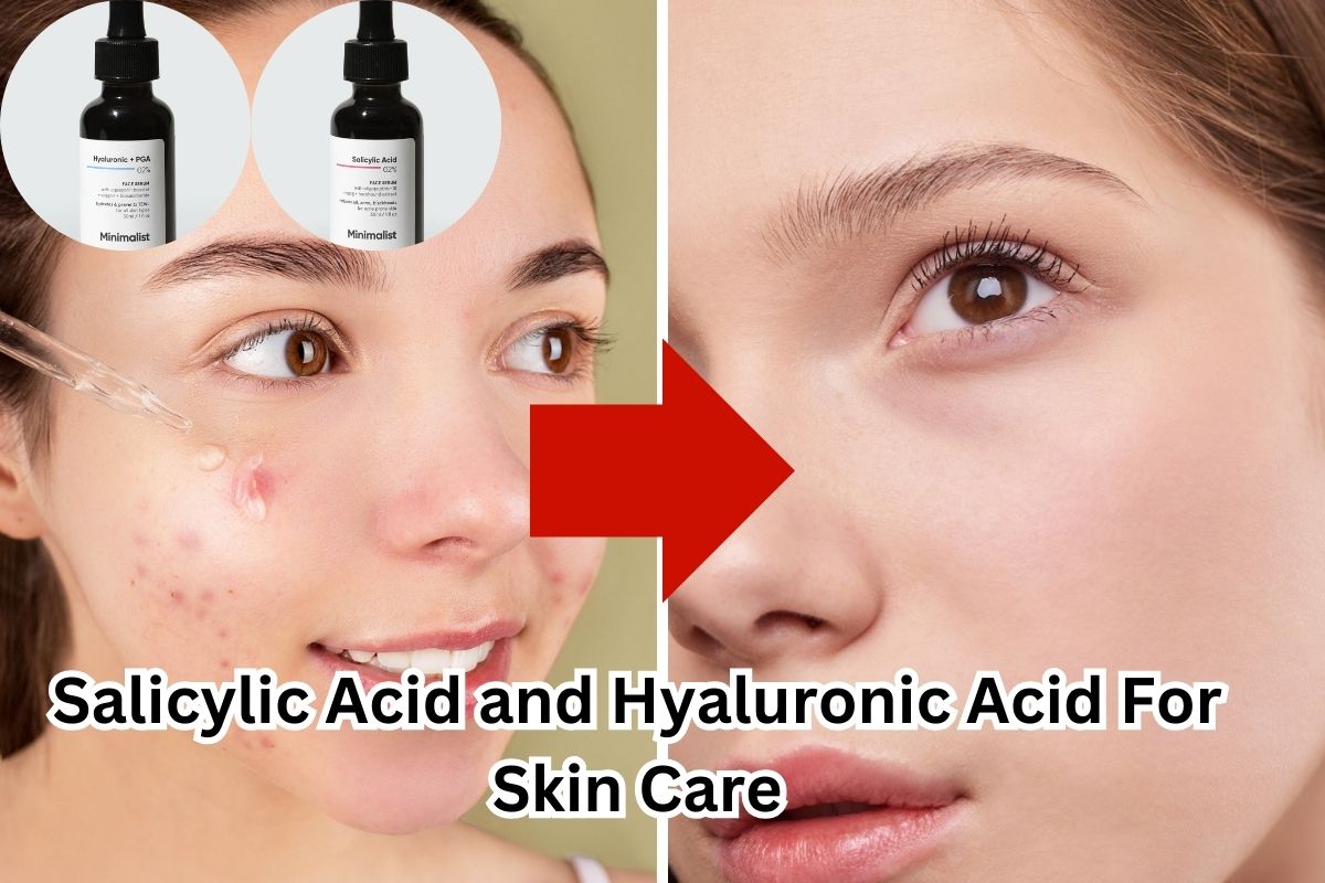 Salicylic Acid and Hyaluronic Acid: Reduce the Signs Aging and Improve Your Skin