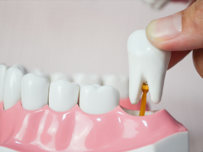 Understanding Wisdom Tooth Extraction: When Is It Necessary?