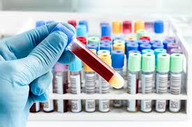IgE Allergy Blood Tests Market Research Report: Global Industry Overview 2019 to 2026
