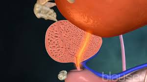 Benign Prostatic Hyperplasia (BPH) And Prostate Treatment Market Size, Growth, Industry Demand and Forecast, 2019–2026
