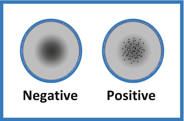 Rapid Plasma Reagin Test Market: Future Opportunities, Analysis & Outlook To 2026