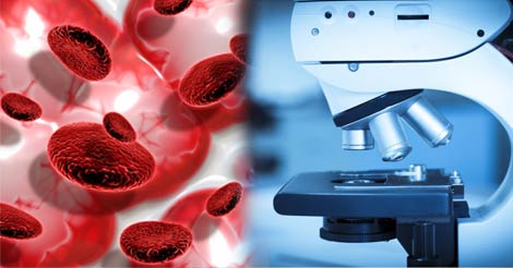 Cancer Diagnosis Market Size, Growth, Industry Demand and Forecast, 2020–2026