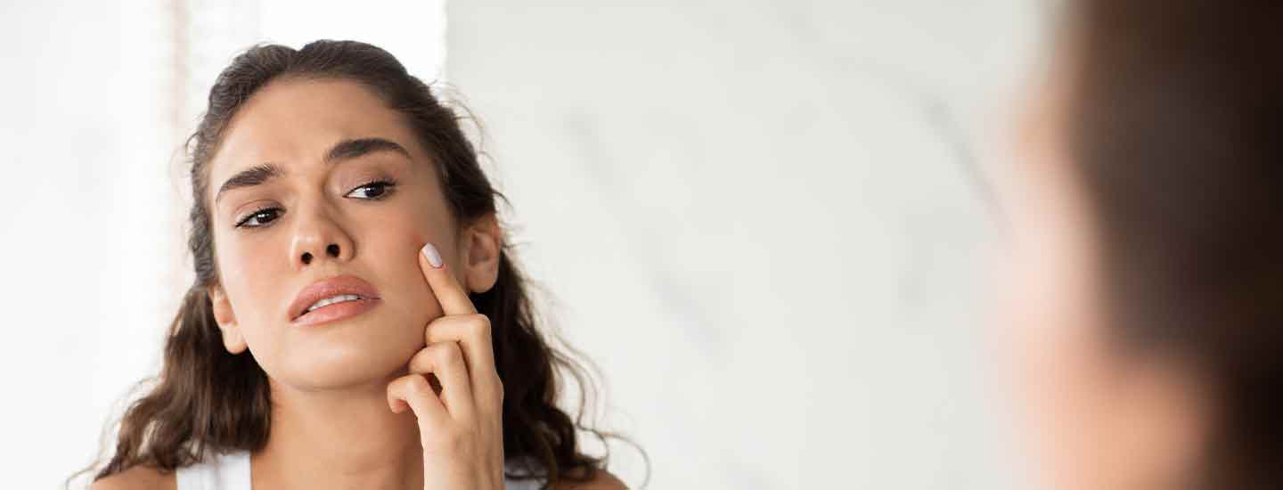 How Do You Get Rid of Painful Acne?