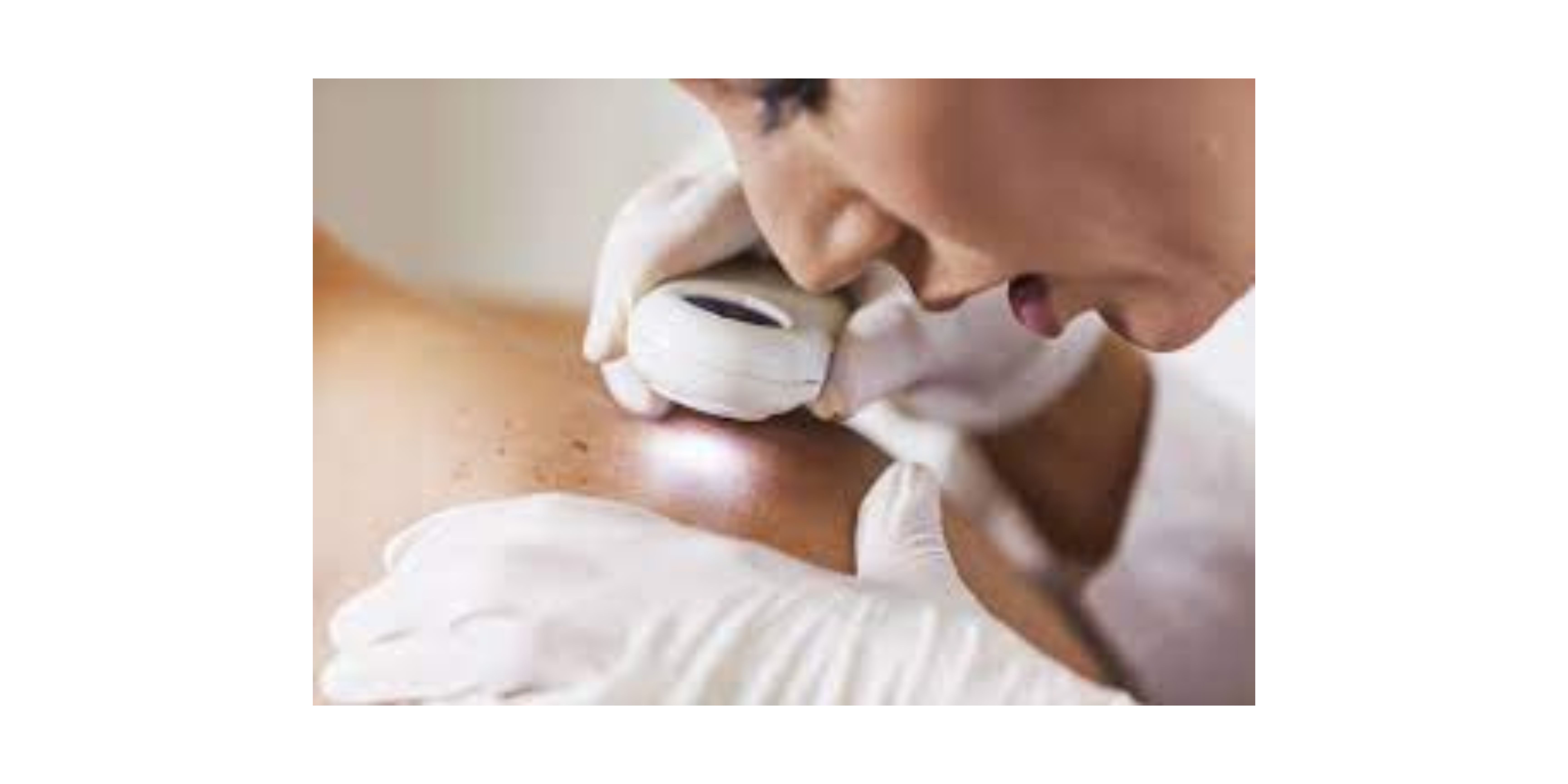 Looking for a Good Dermatologist?