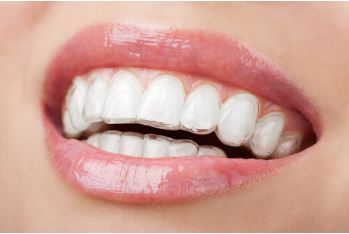 Achieving a Straighter Smile: Why an Invisalign Dentist is Your Best Choice