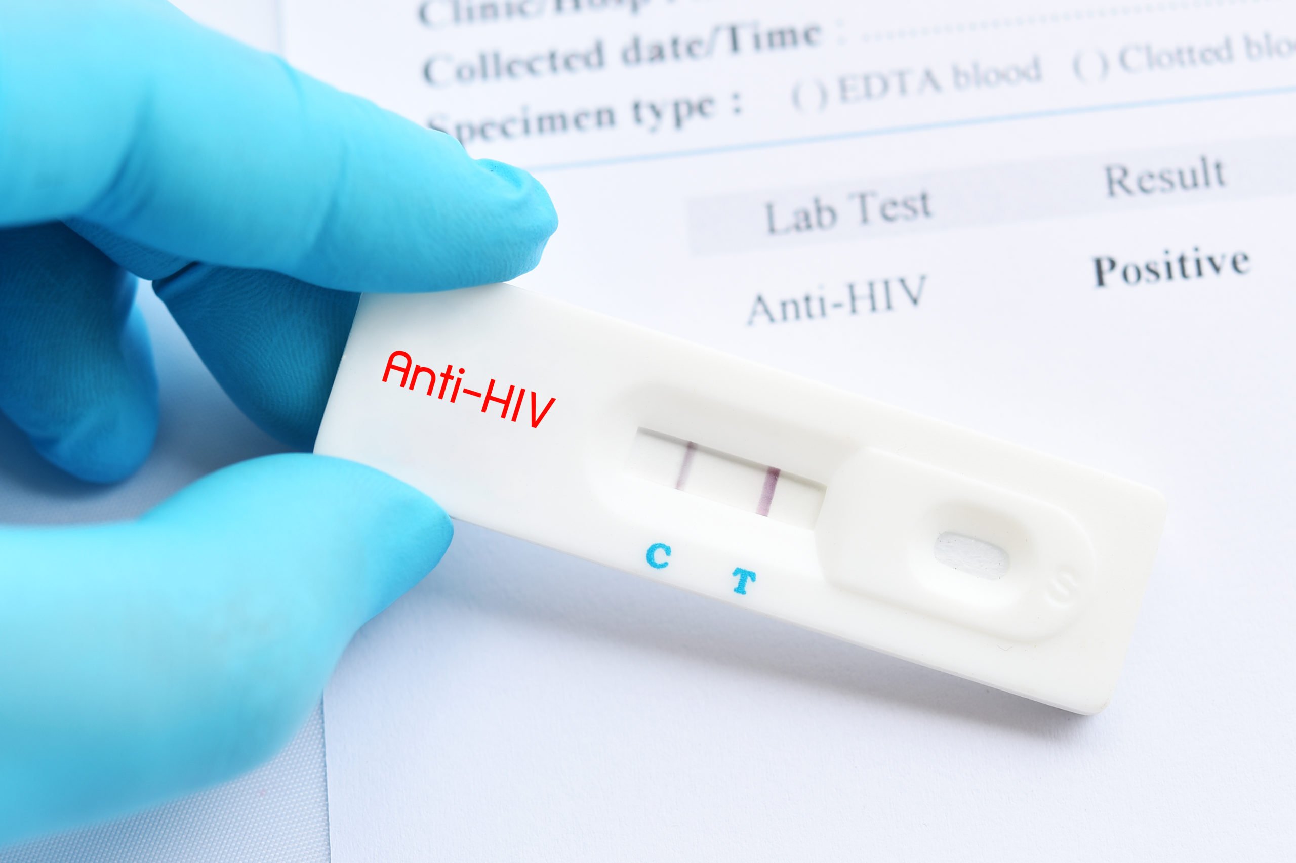 Asia Pacific HIV Diagnostics Market: Unlocking New Potential   