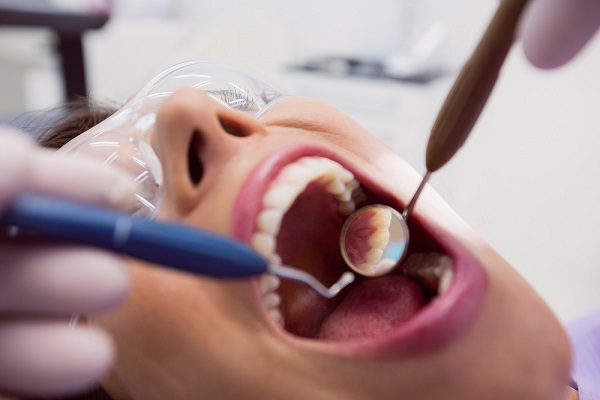 Do Dental Implants Get Cavities?