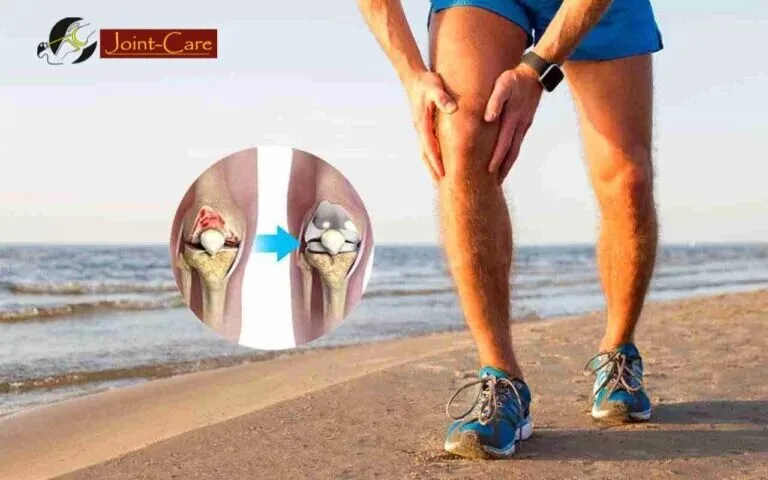 Understanding Arthritis: Types, Symptoms, and Treatment Options