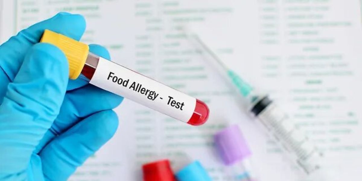 Unveiling the Importance of Food Intolerance and Allergy Tests
