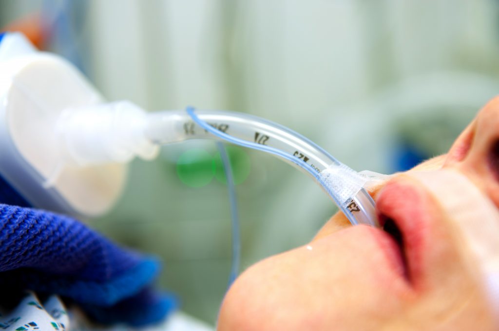 Rapidly Expanding Market Opportunities in Endotracheal Tube Market 