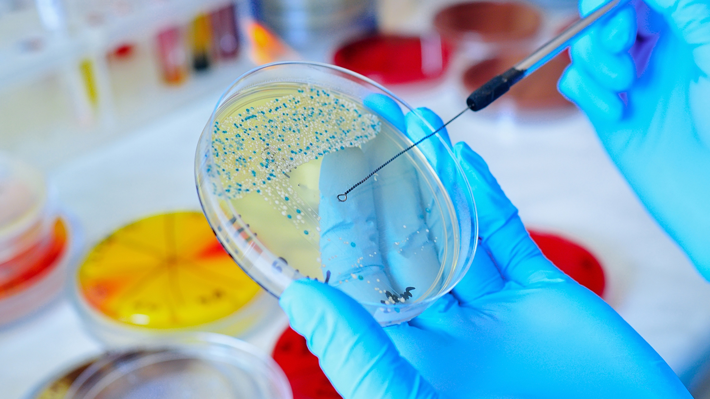 The Global Histology And Cytology Market Growth Accelerated By Increasing Prevalence Of Chronic Diseases