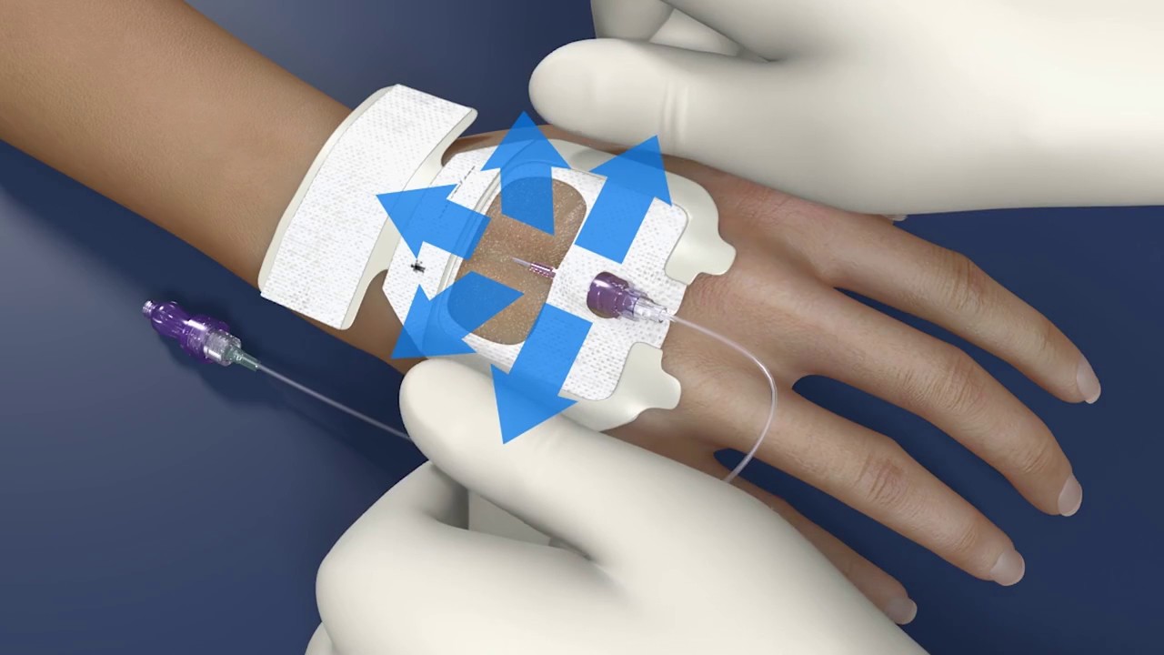 Infusing Growth: Navigating Opportunities in the IV Dressing Market