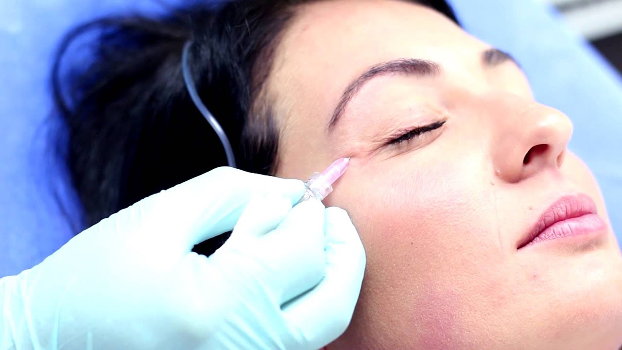 Carboxy Therapy Market will drive facial rejuvenation owing to rising demand for non-invasive aesthetic procedures