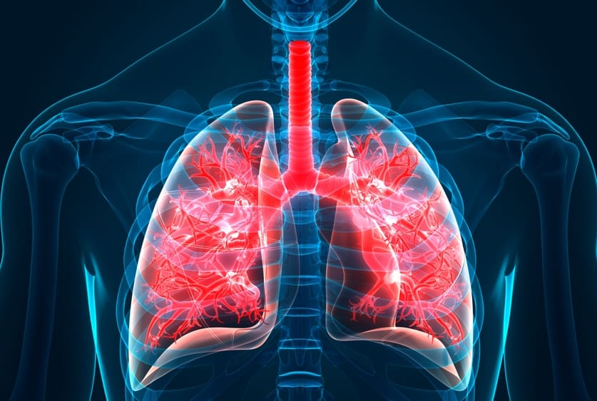 Idiopathic Pulmonary Fibrosis: An Explainer