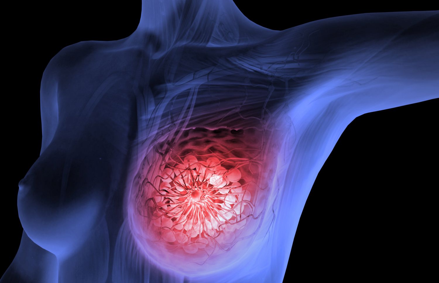 Breast Imaging: Understanding Your Options