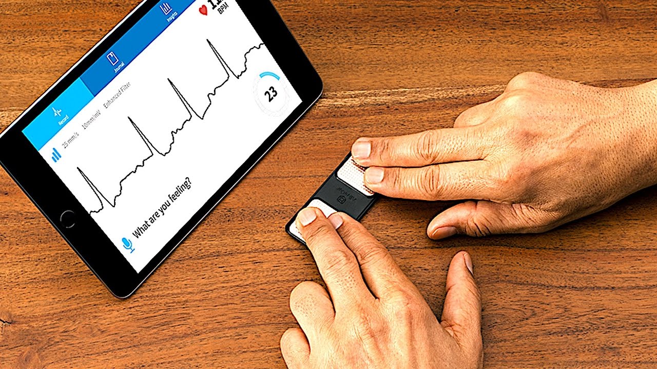 Heart Health Goes Mobile: Exploring Global Mobile ECG Devices