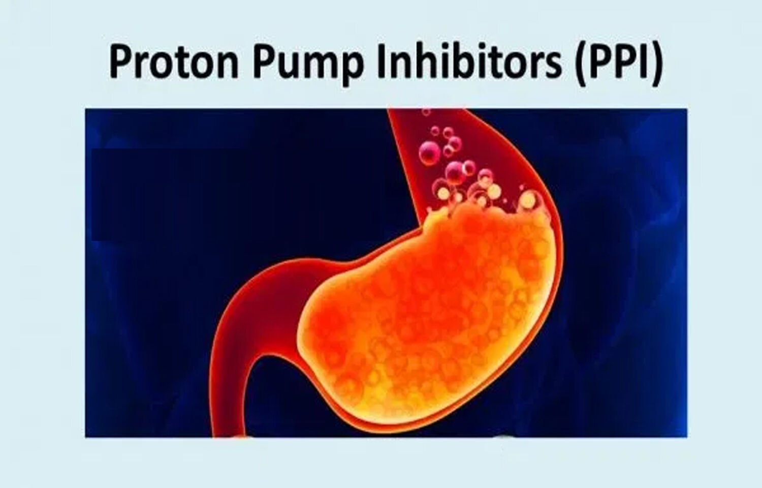 Proton Pump Inhibitors Market is Estimated to Witness High Growth Owing to Increase in Gastrointestinal Problems 