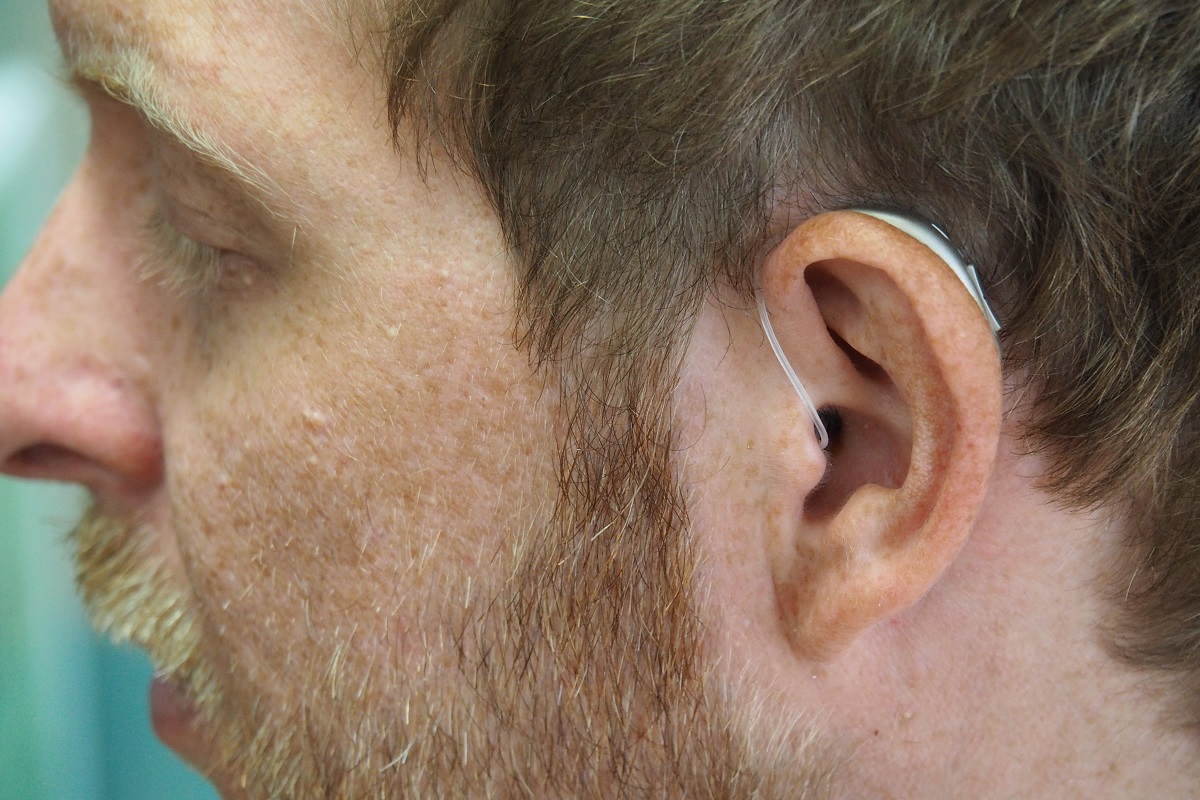 Unlocking Better Hearing: The Role of Hearing Aid Fitting