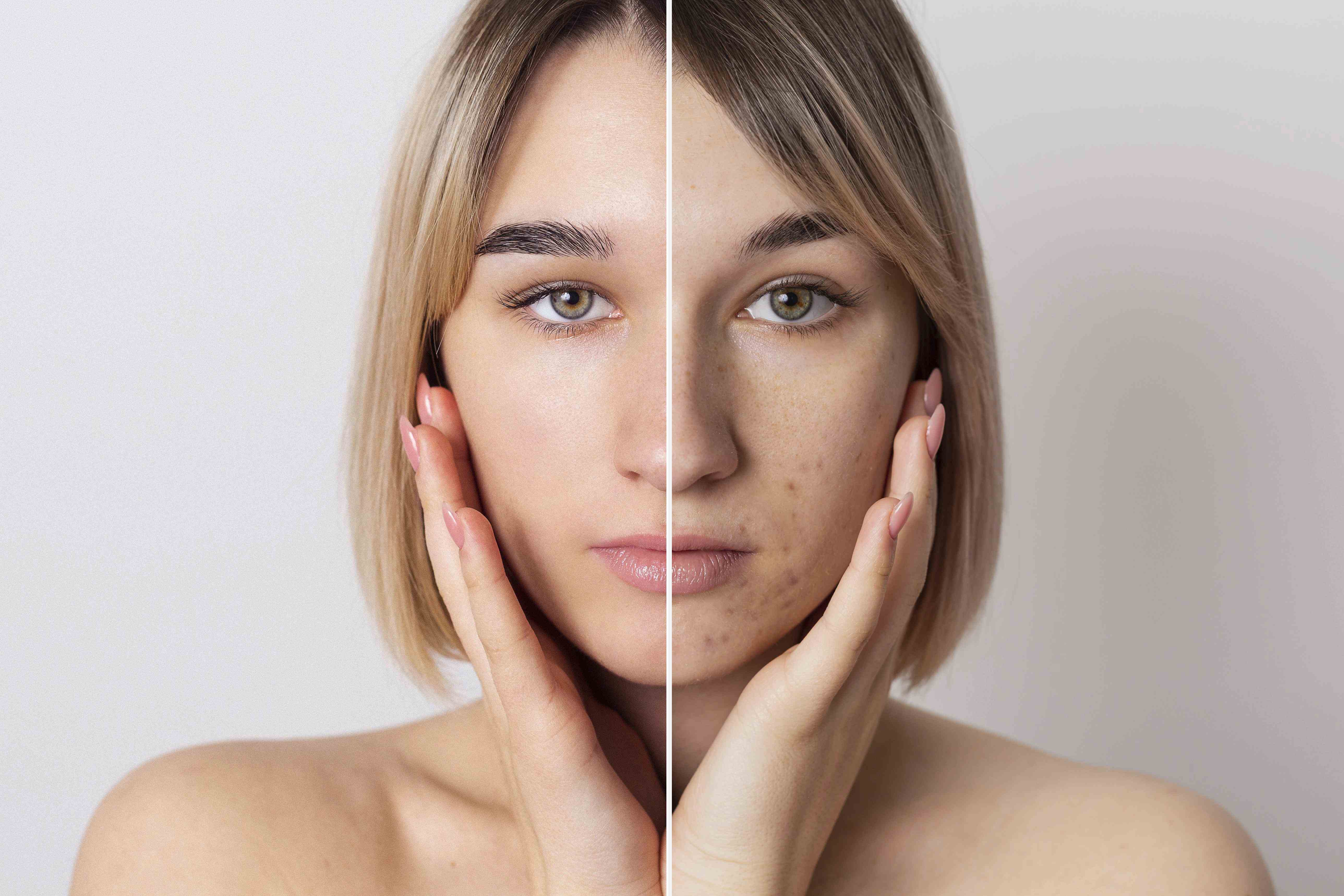 Empowering Confidence: RK Derma Clinic as the Premier Dermatology Destination in Kompally