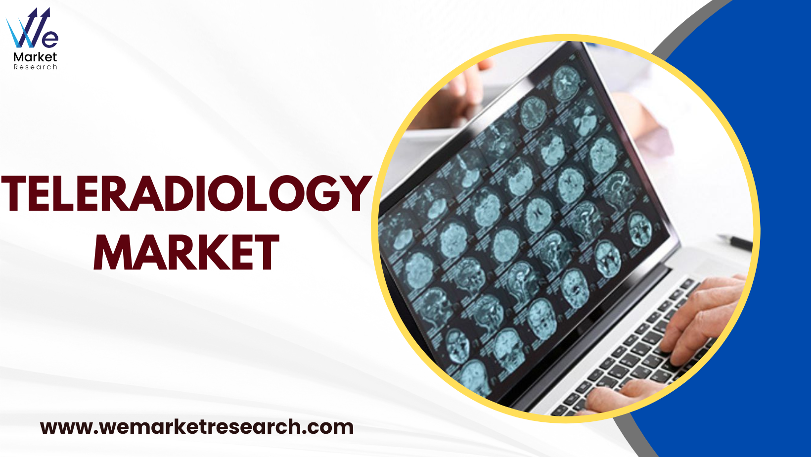 Teleradiology Market Analysis, Growth Factors and Competitive Strategies by Forecast 2033 