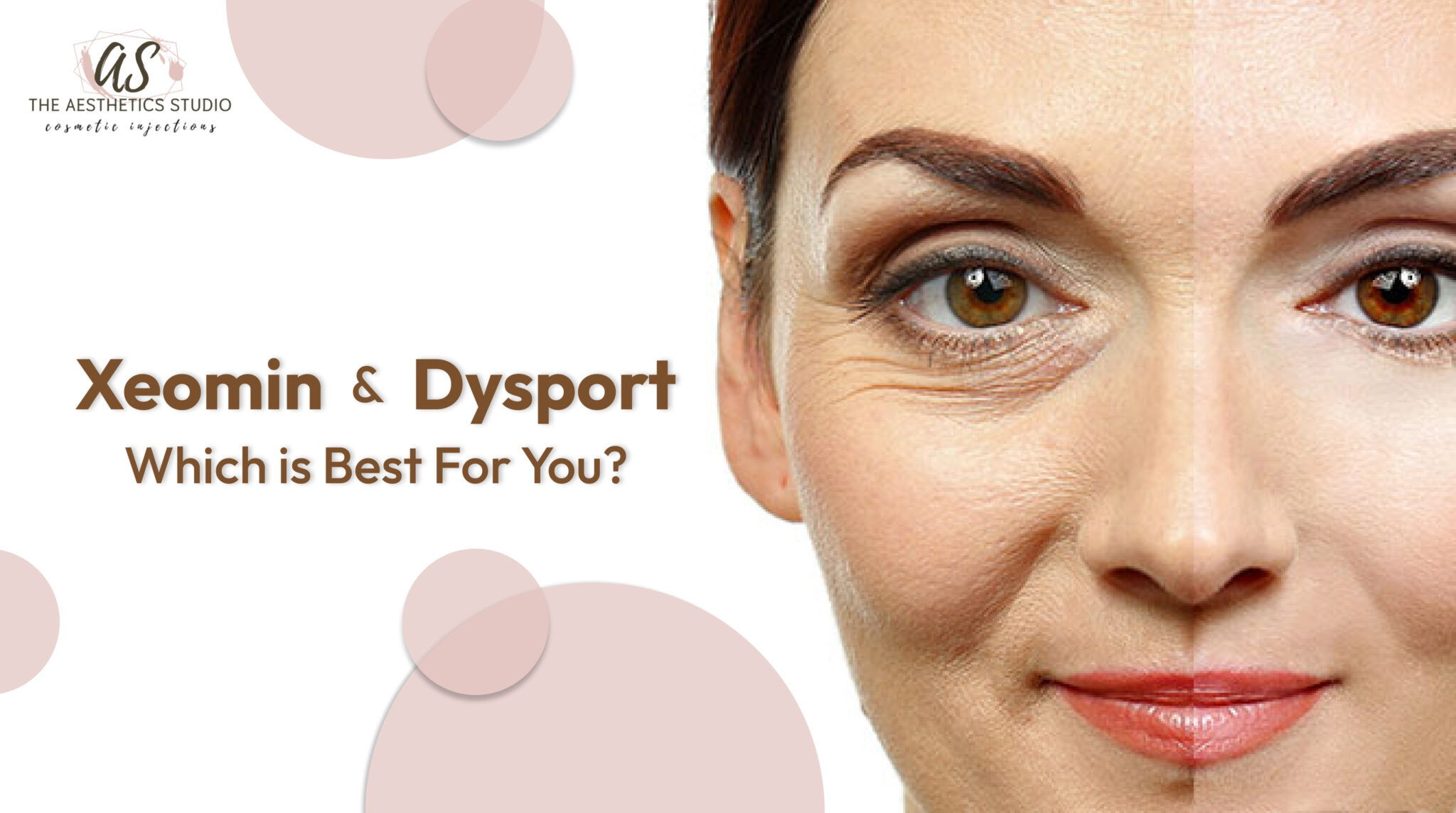 Xeomin vs. Dysport: Which Is Best For You?