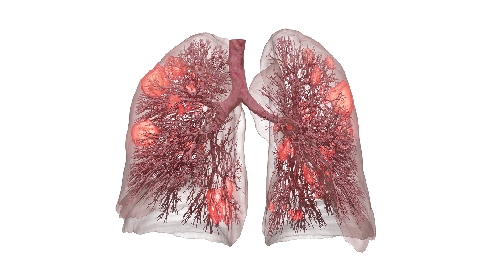 Exploring the Significance of Global In Vitro Lung Models