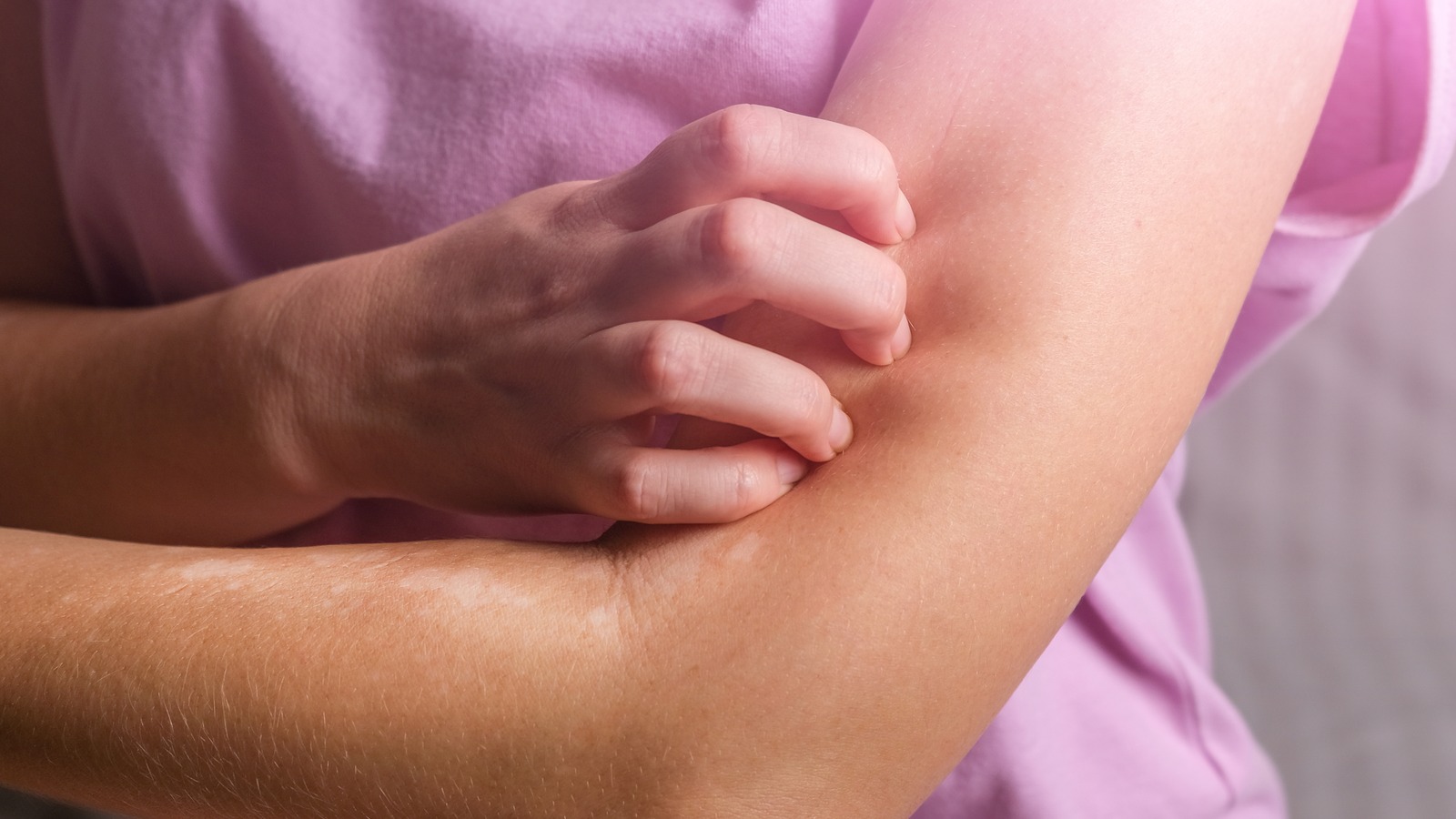 Navigating the Skin Rash Treatment Market: An Insightful Analysis